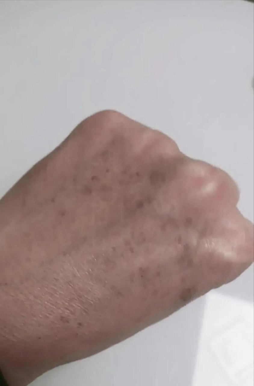 这手才25岁你信吗,该怎么办