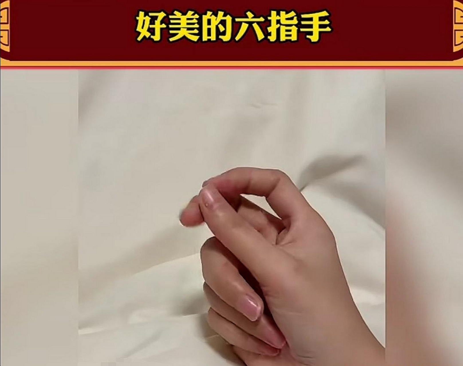 网友:原来六个手指头的手居然这么好看呀![吃鲸]