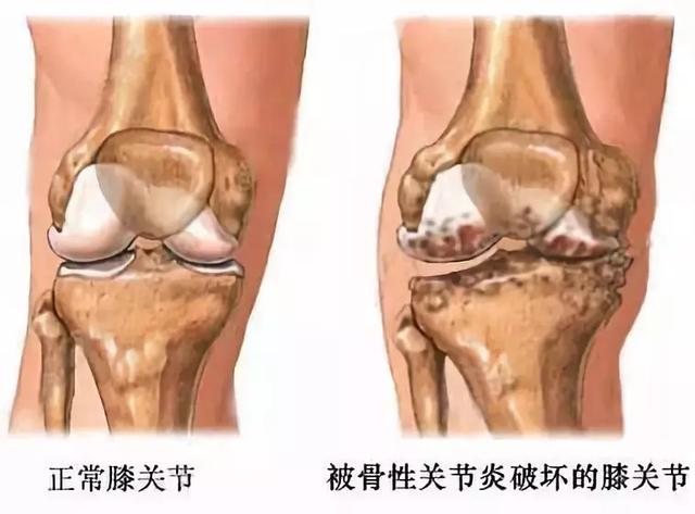 关节腔位置图图片