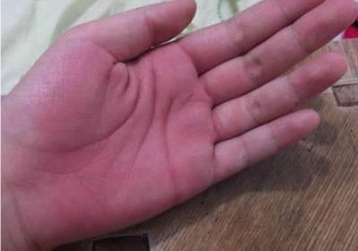 手上若出现这四种异常情况,可能是血管堵了,不要大意了