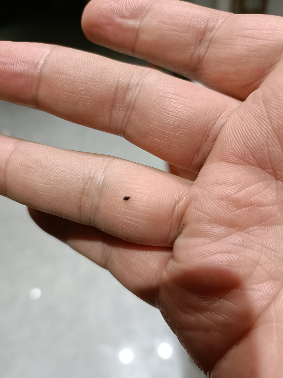 猜猜看 你能想象这个黑点曾经是只蚊子吗?