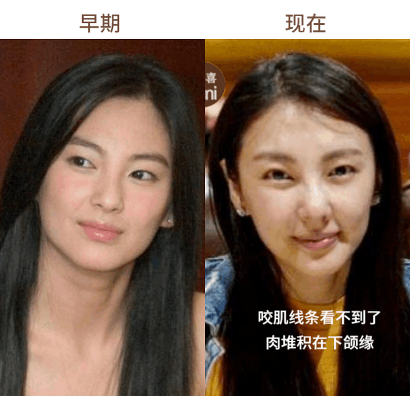 张雨绮是易胖体质,又做了不少光电项目,现在整个人的状态忽上忽下.