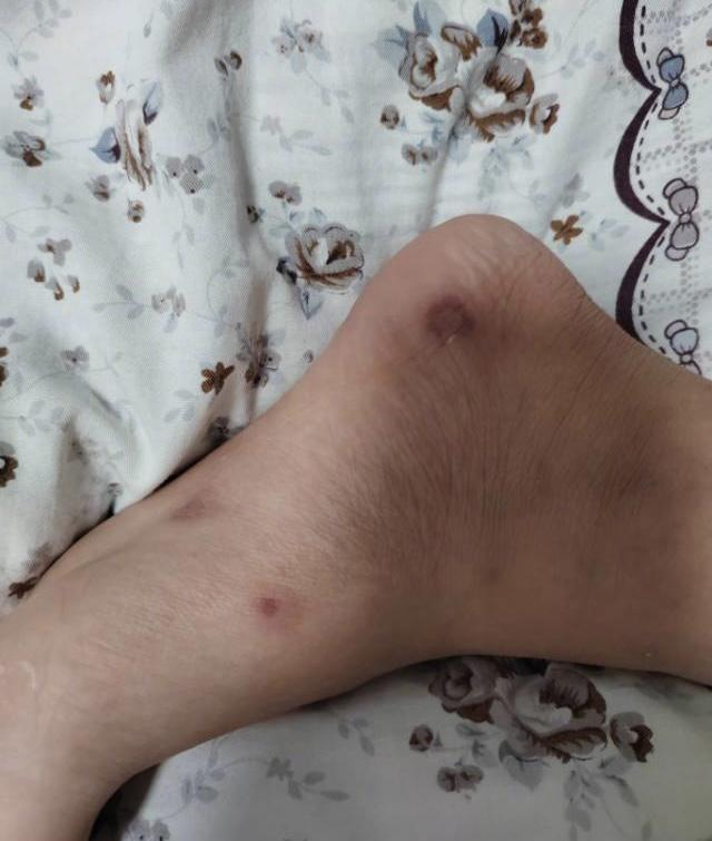 小编是80后,记得那些年年年冻手冻脚,求学时住宿的宿舍非但没有取暖设