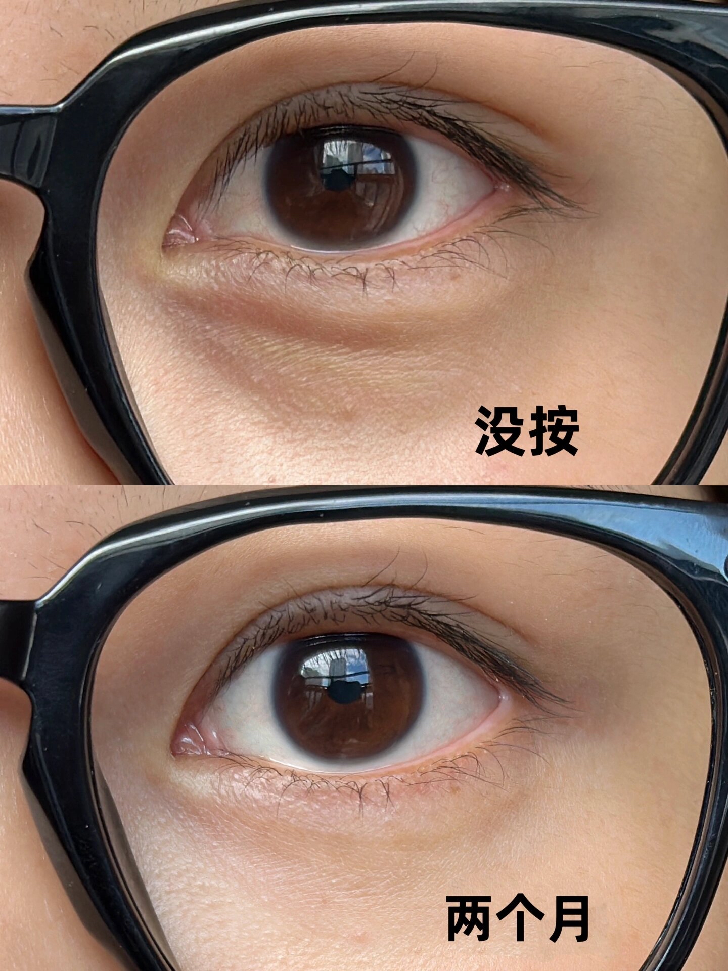 眼部护理黑眼圈 功夫不负有心人 家人们快去练 真的特别的有效