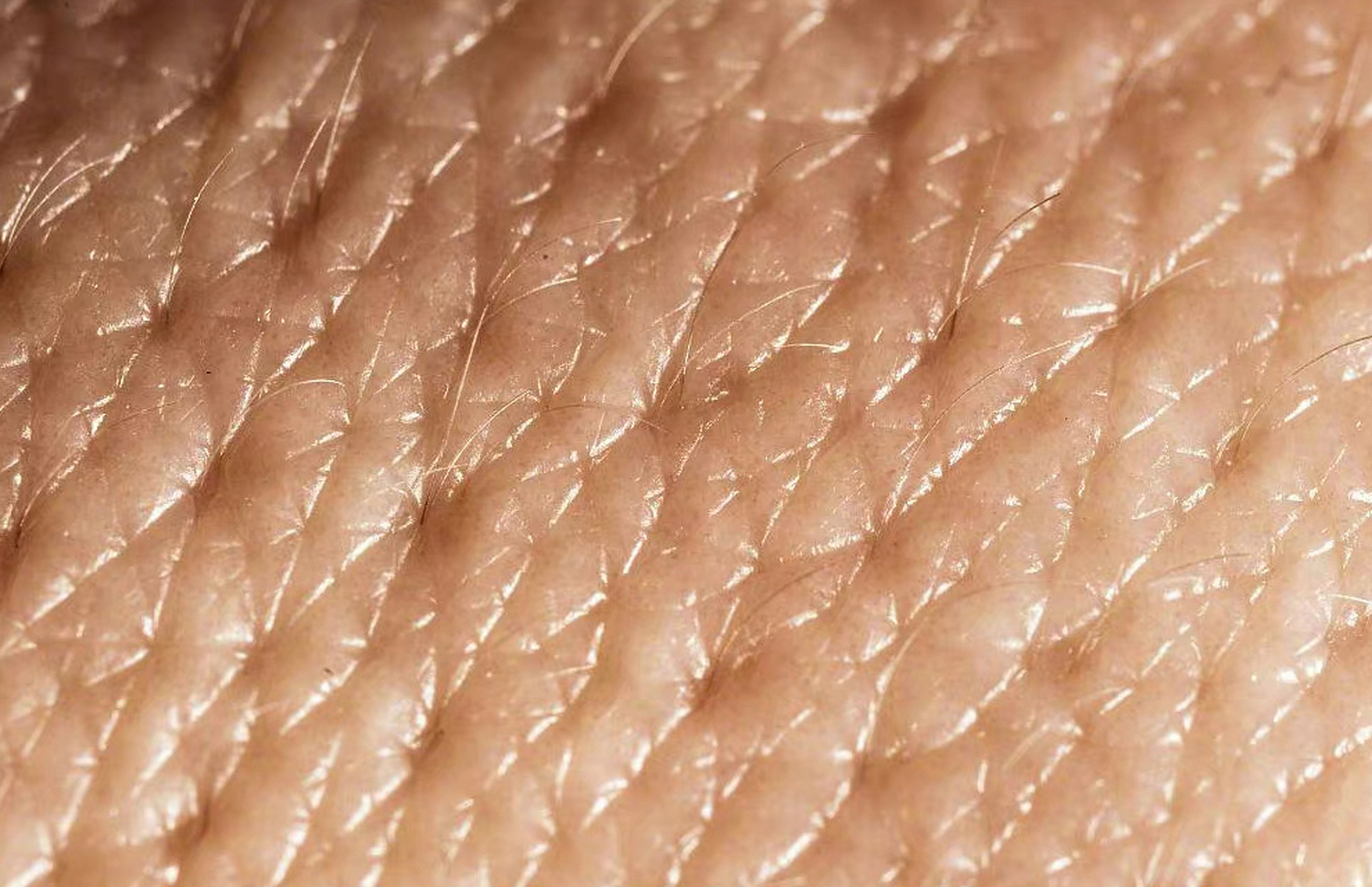 显微镜下的人体皮肤和汗毛.