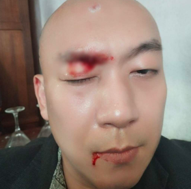 突发事件!香港tvb男星李嘉在内地拍戏时遭遇意外,引发热议