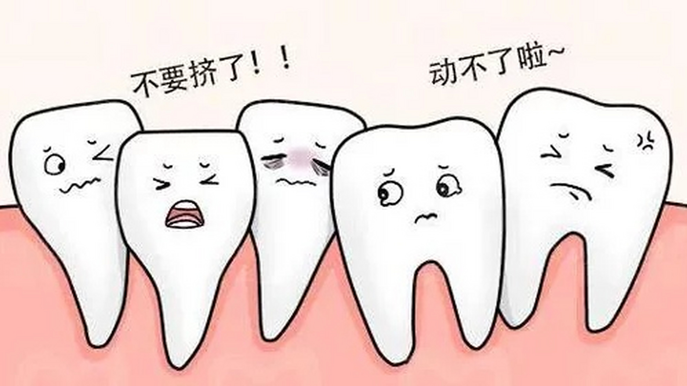 #牙齿矫正# 造成牙齿拥挤的原因有哪些?  牙齿拥挤是错颌畸形中最常见