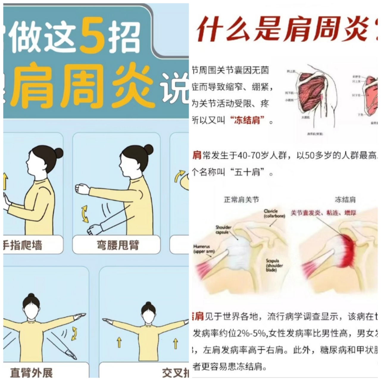 常用这5招和它说拜拜     肩周炎症状有哪些?