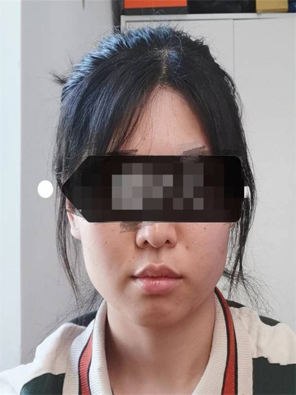 瘦脸针一针解决!