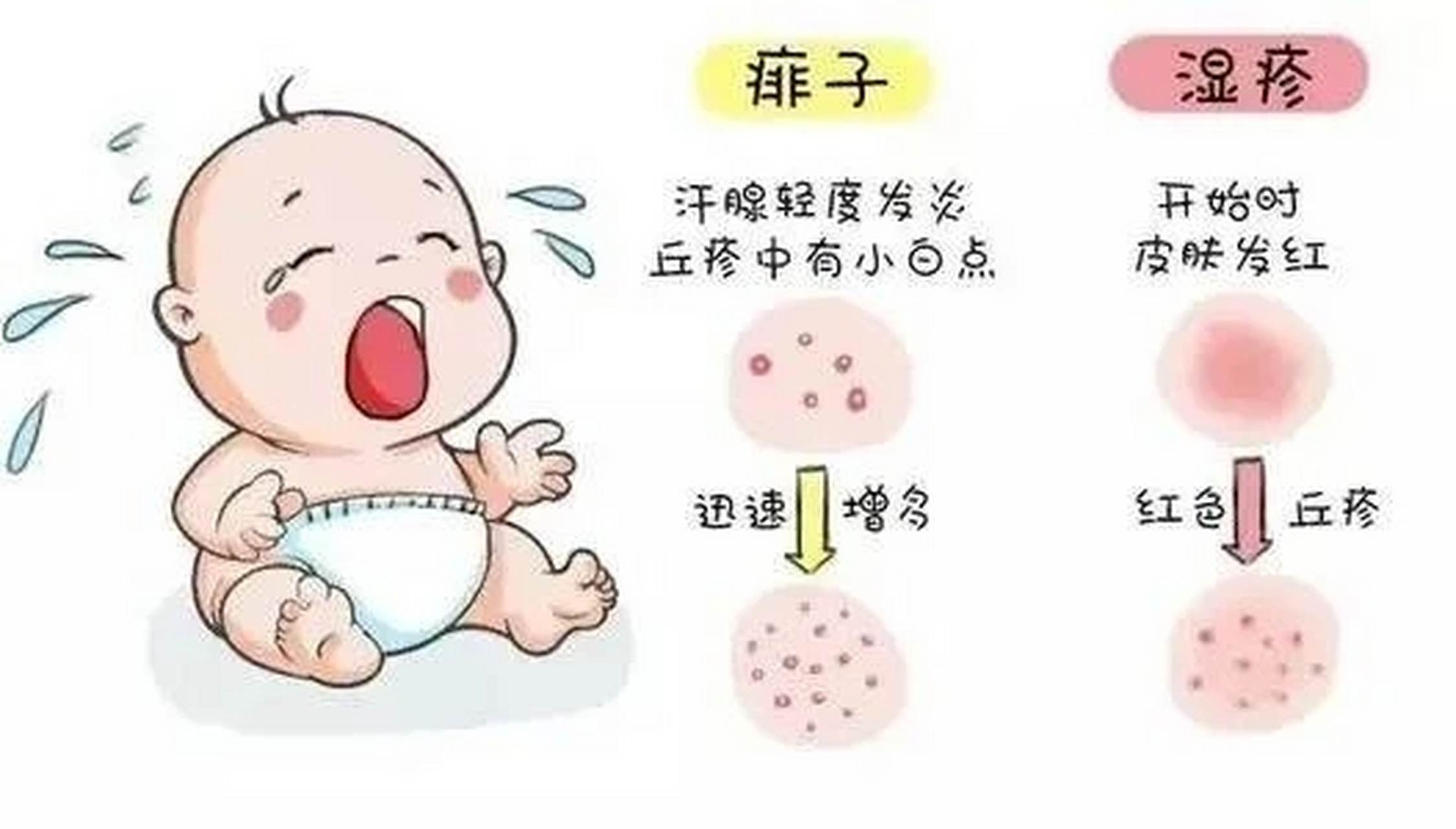 【每日一方】痱子外用方!