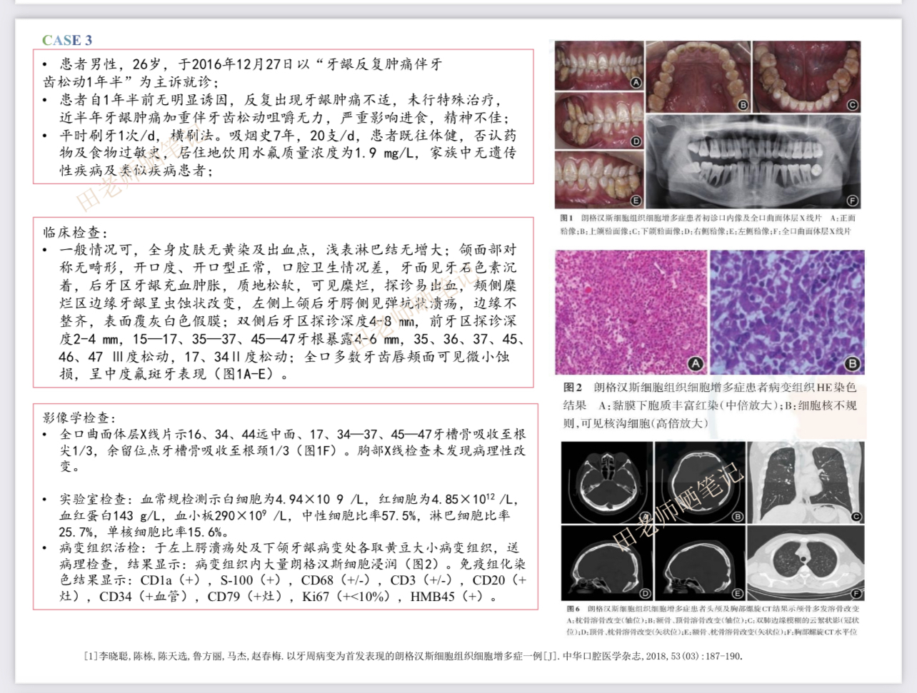 朗格汉斯细胞作用图片