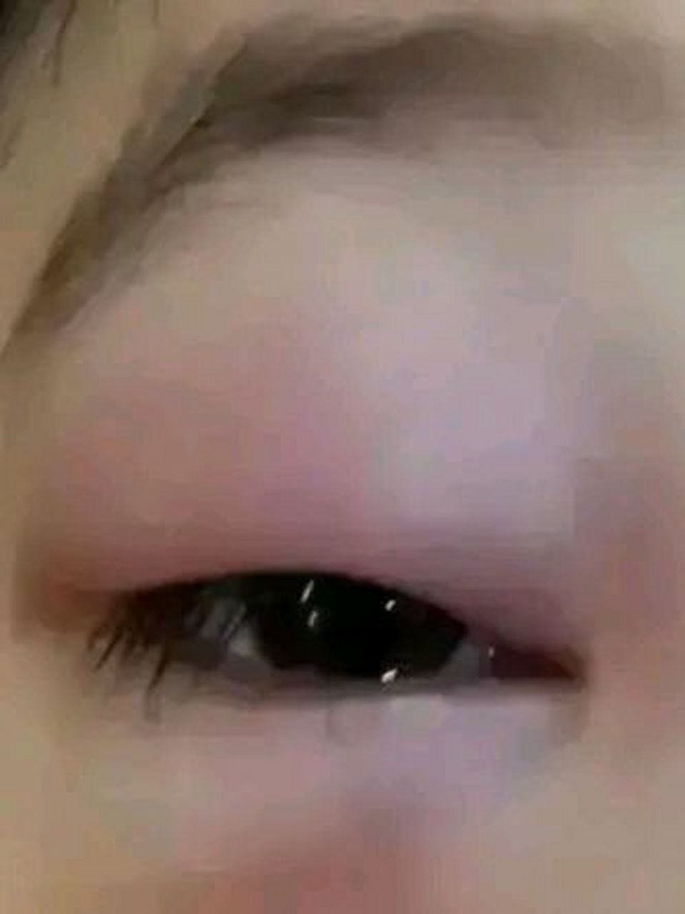 感染后眼睛肿得像水蜜桃# 昨天,富士康车间一管理人