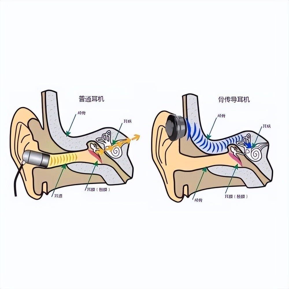 骨传导耳机结构图图片