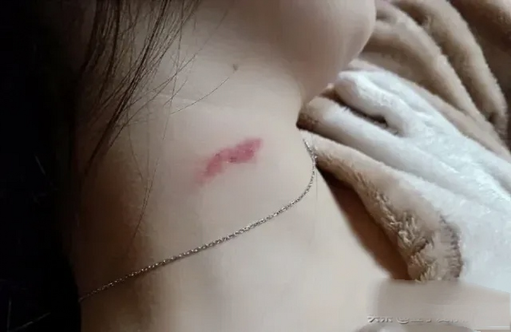 最近发现一个奇怪的现象,我的一位同事他脖子经常出现草莓印,我根本不