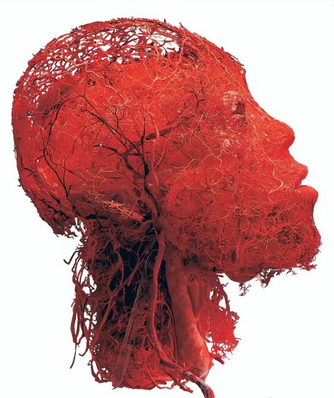 这就是人体头部的血管分布图, 每一寸皮肤都覆盖着血管