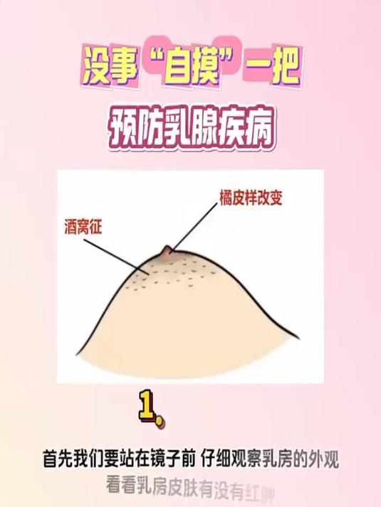 乳腺最初桔皮样图片图片