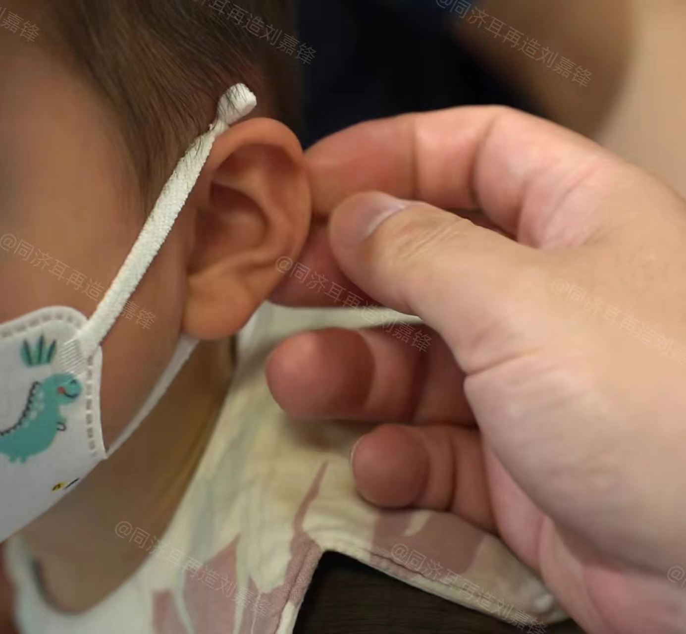 因为五岁的时候,耳朵慢慢停止发育,不会再长大