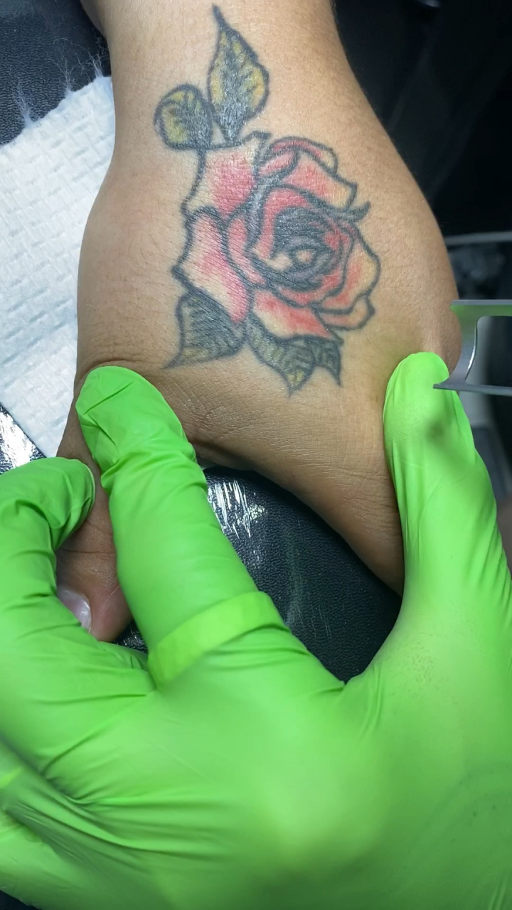 可是,纹身洗涤不当很容易留下难看的疤痕,这让人很是犯愁.