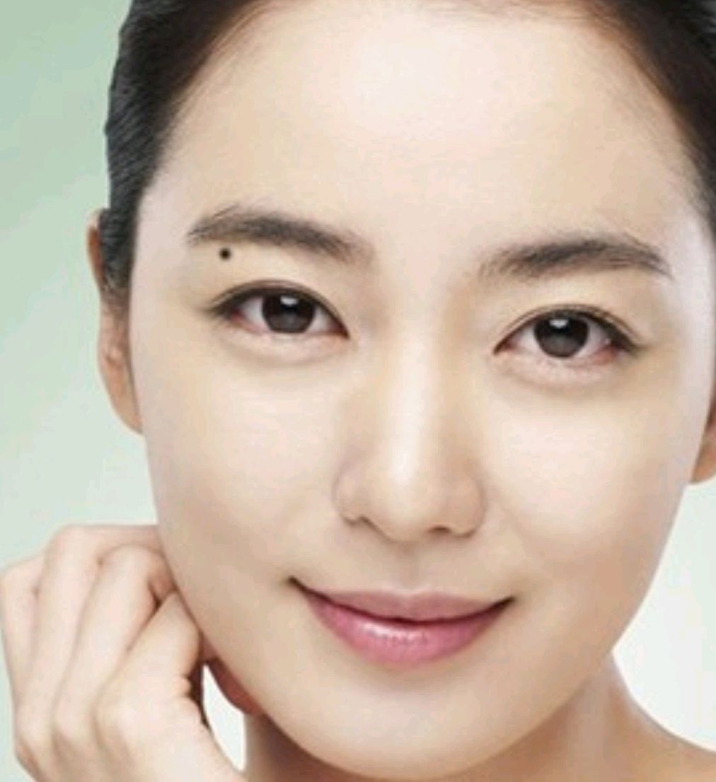 长在脸上的美人痣!