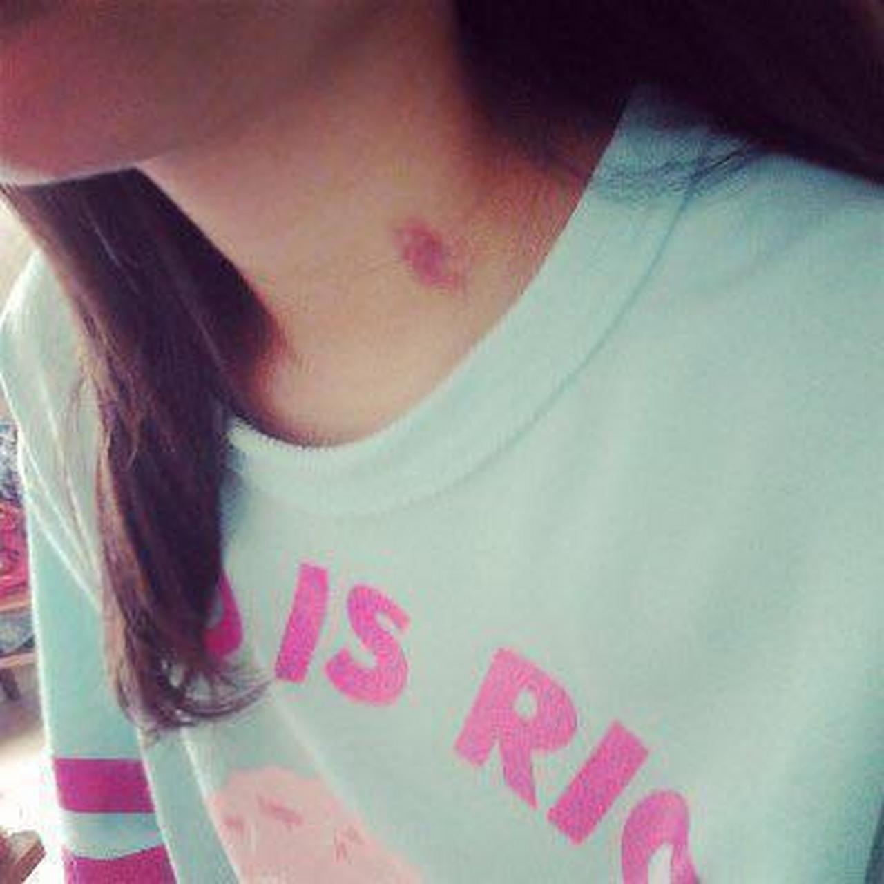 昨晚,我拿着手机玩游戏,老公在我脖子上嘬了一颗草莓印.