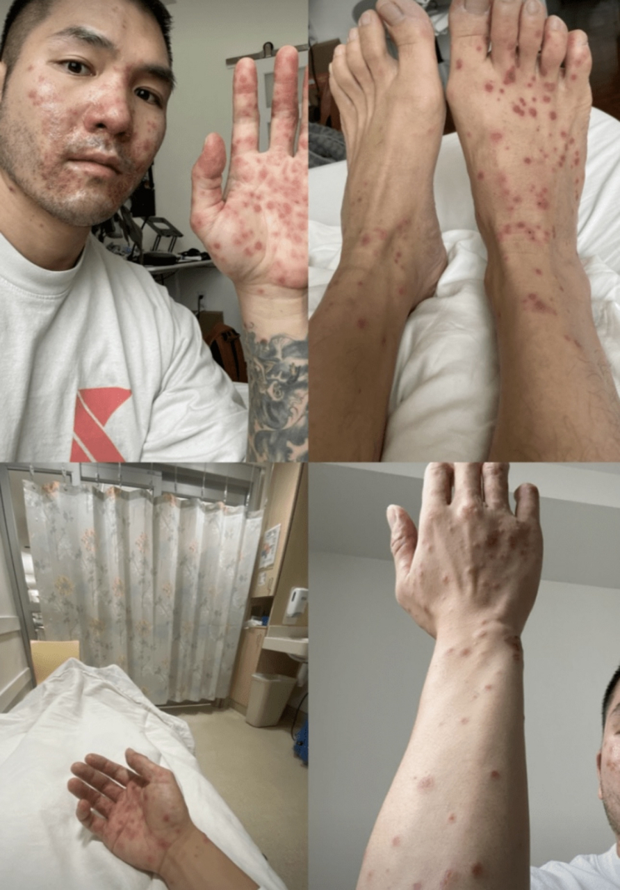 四十度的高温,我吓出一身冷汗95!