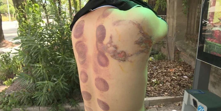 电视台调解赔偿4000元