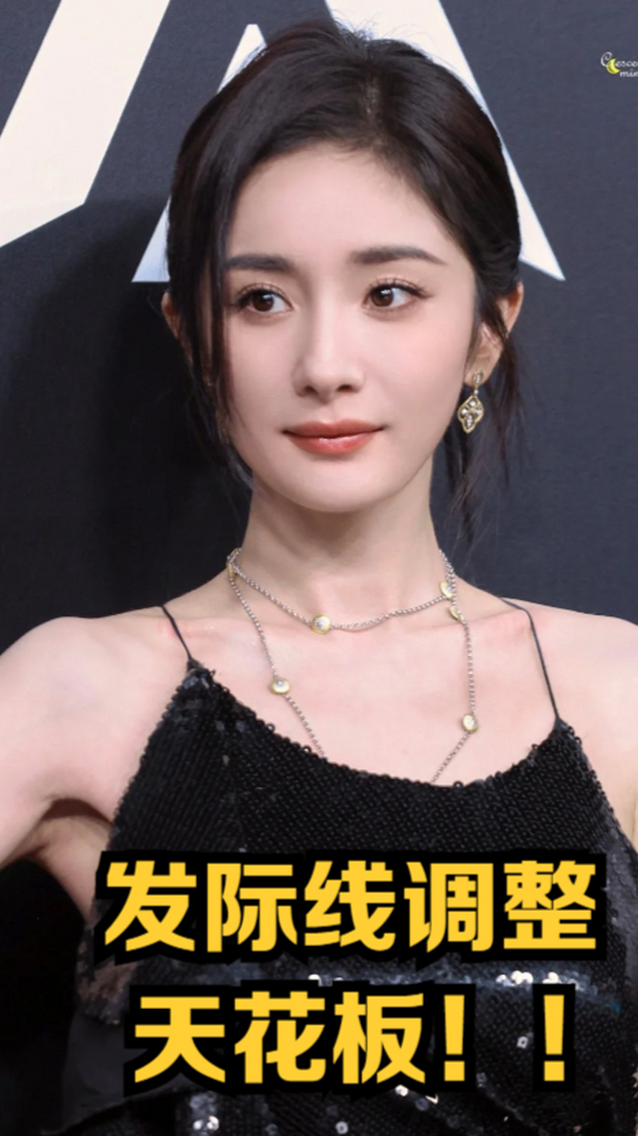 发际线调整天花板!