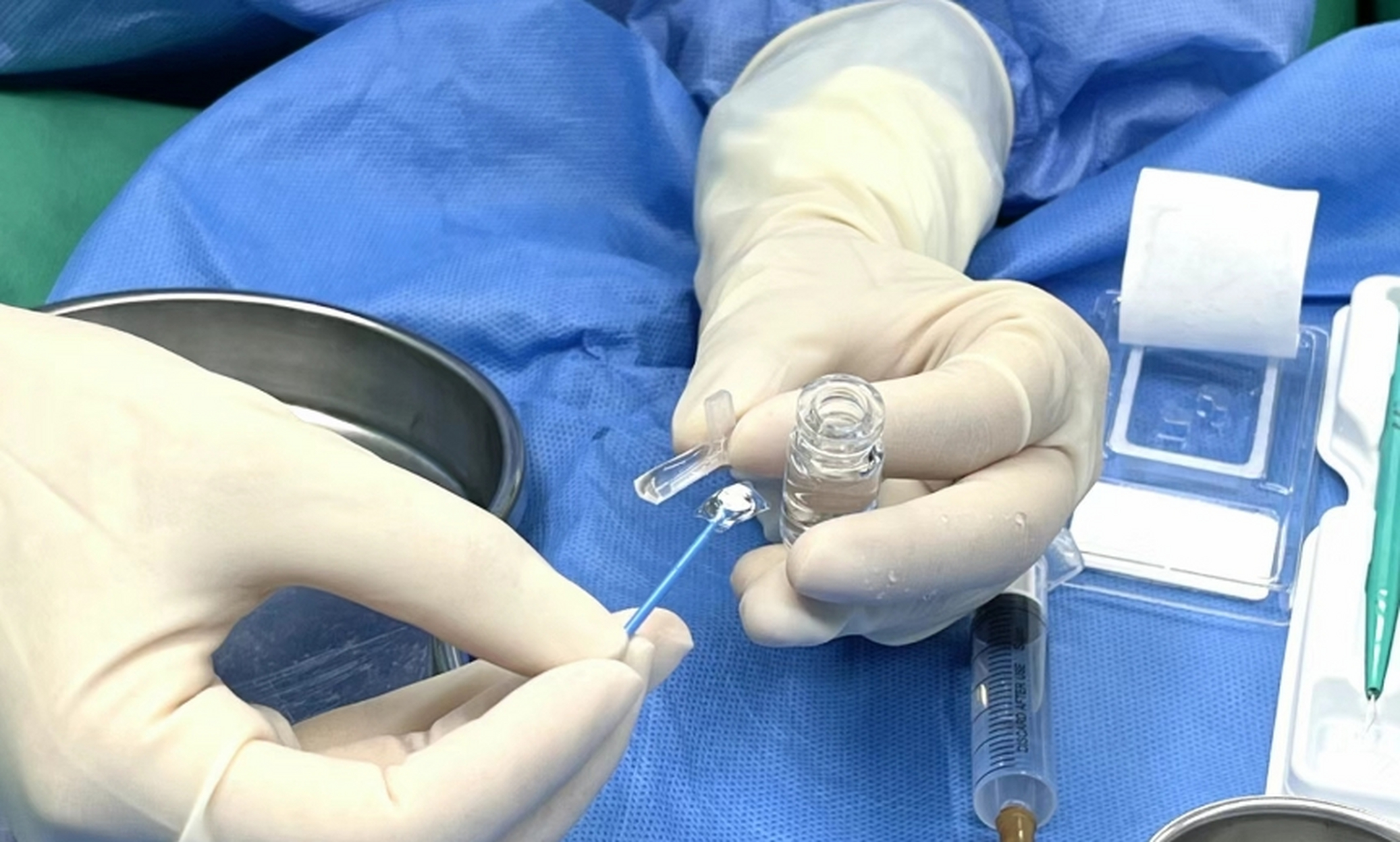 晶体手术术前术后 #icl晶体植入手术 #南京东南眼科医院# 术前900度