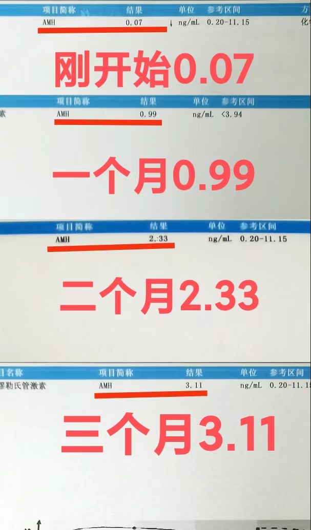 妇科查amh是查什么(amh检查挂妇科还是生殖科)  第2张