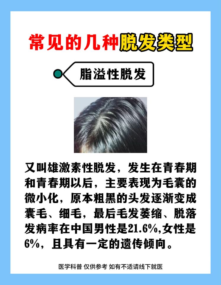 常见的几种脱发类型  #脱发