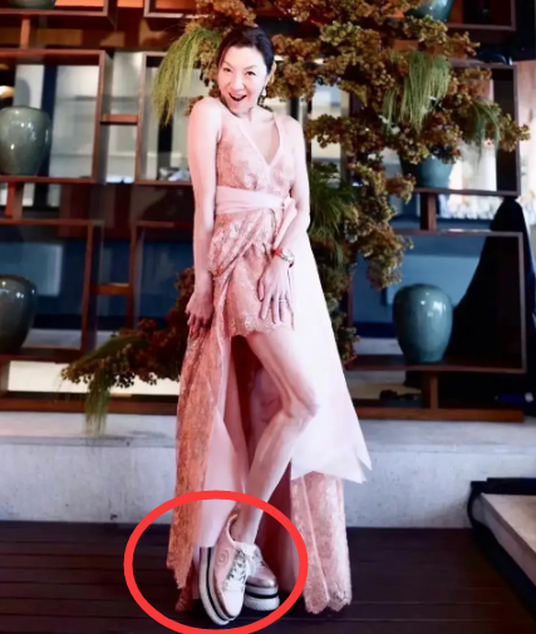 现在才知道,原来是因为她的脚变形有点严重 有的人以为这是她练舞蹈