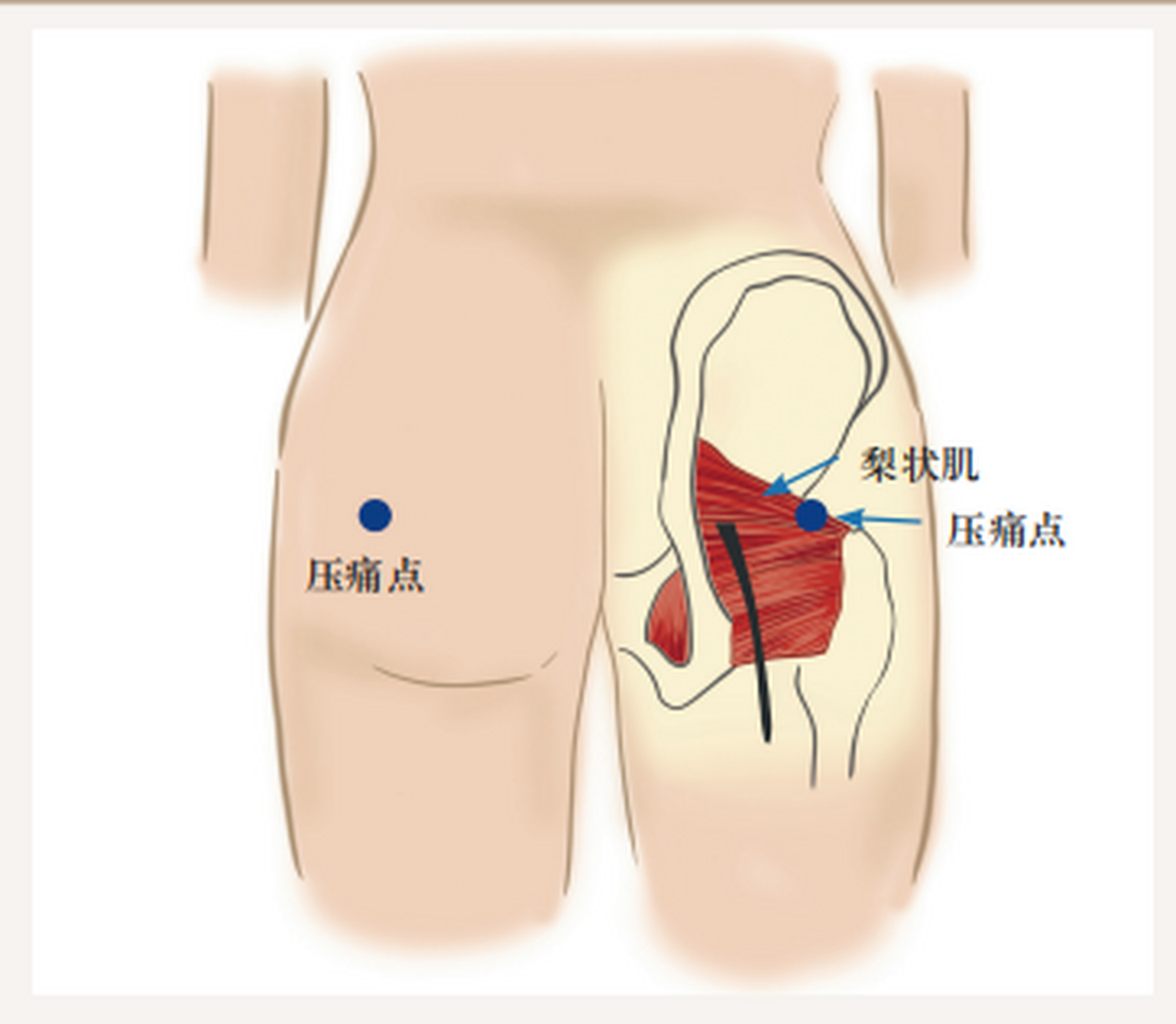 臀部部位示意图图片