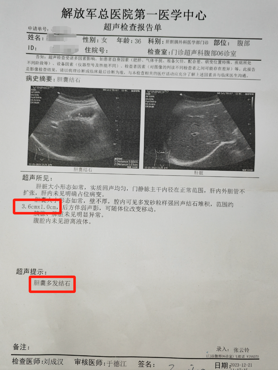 胆结石检查结果图片图片