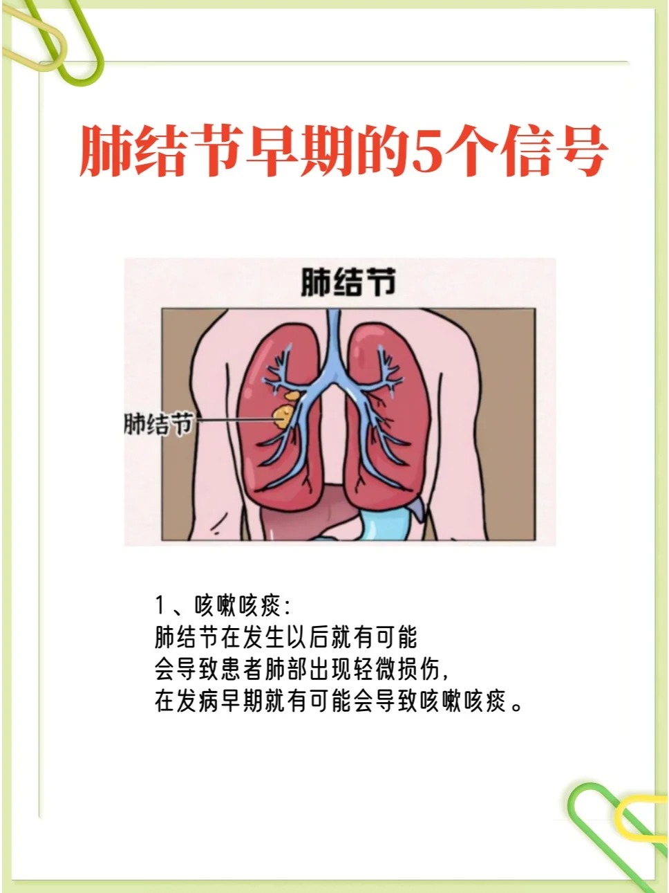 肺结节早期的5个信号!不看拍再多ct没用!