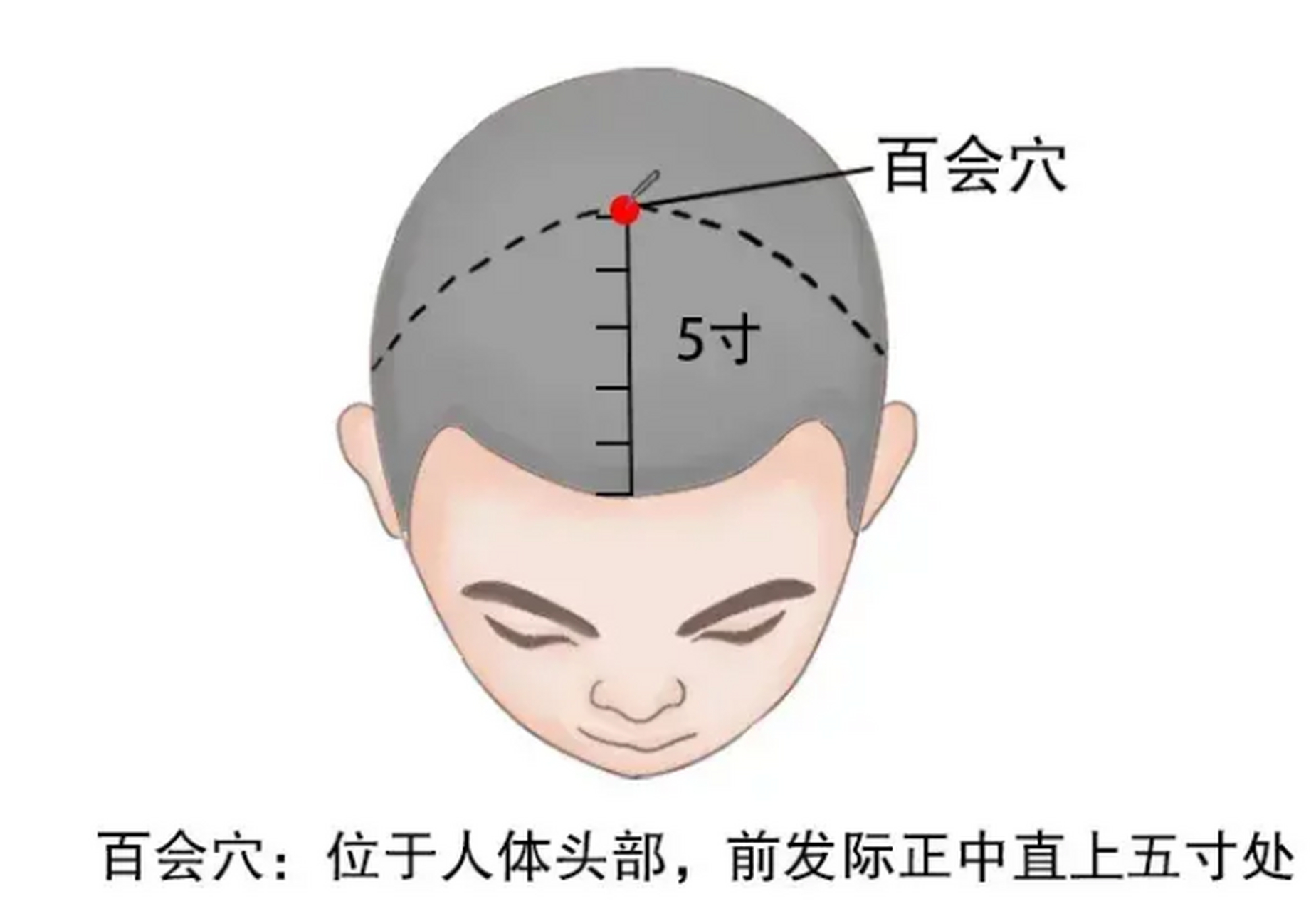 百会位置图片