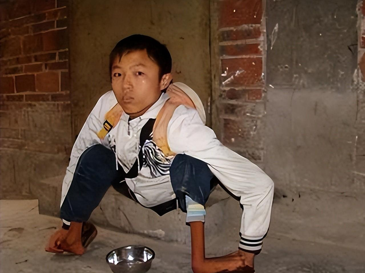 残疾小乞丐龚忠诚:汶川地震连续4次捐款185元,如今自食其力