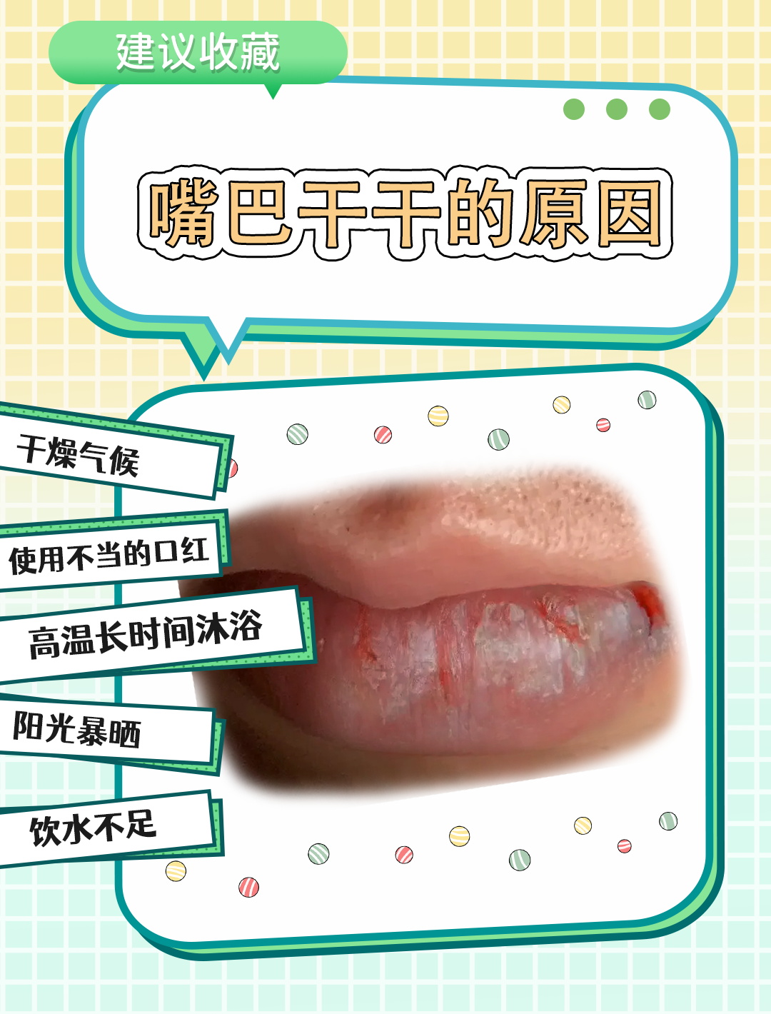 为什么嘴唇很干 为什么嘴唇很干