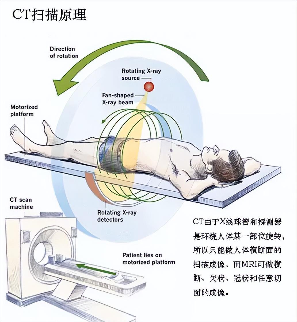 拍CT贵是有道理的?损耗按秒计算的核心零件,现在还只能靠进口!