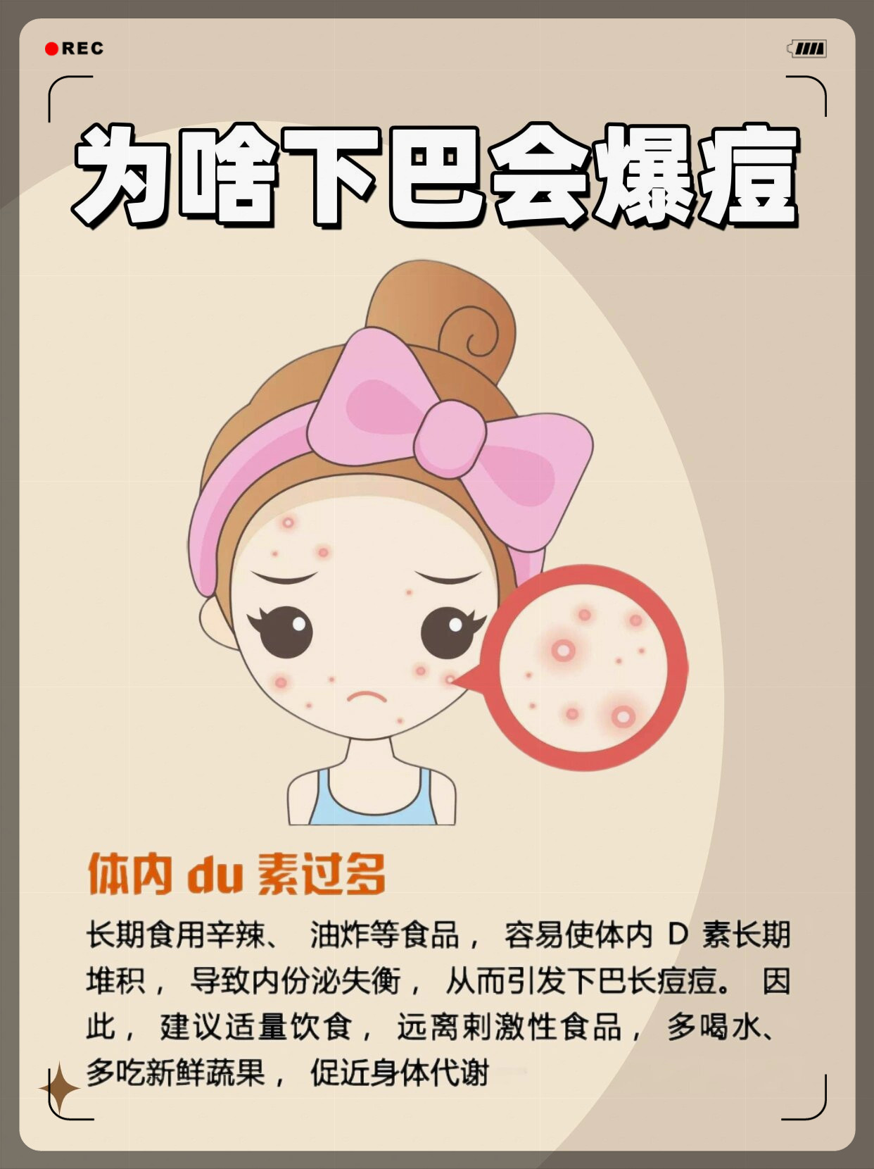此起彼伏卡通图下巴长痘痘是因为什么原因引起的下巴痘痘动画