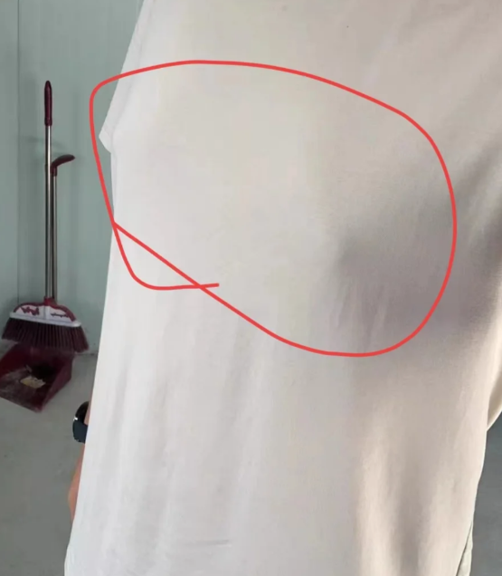 大概经历了两个多小时,迷迷糊糊的被推回到病房了,还是有点困,又睡着