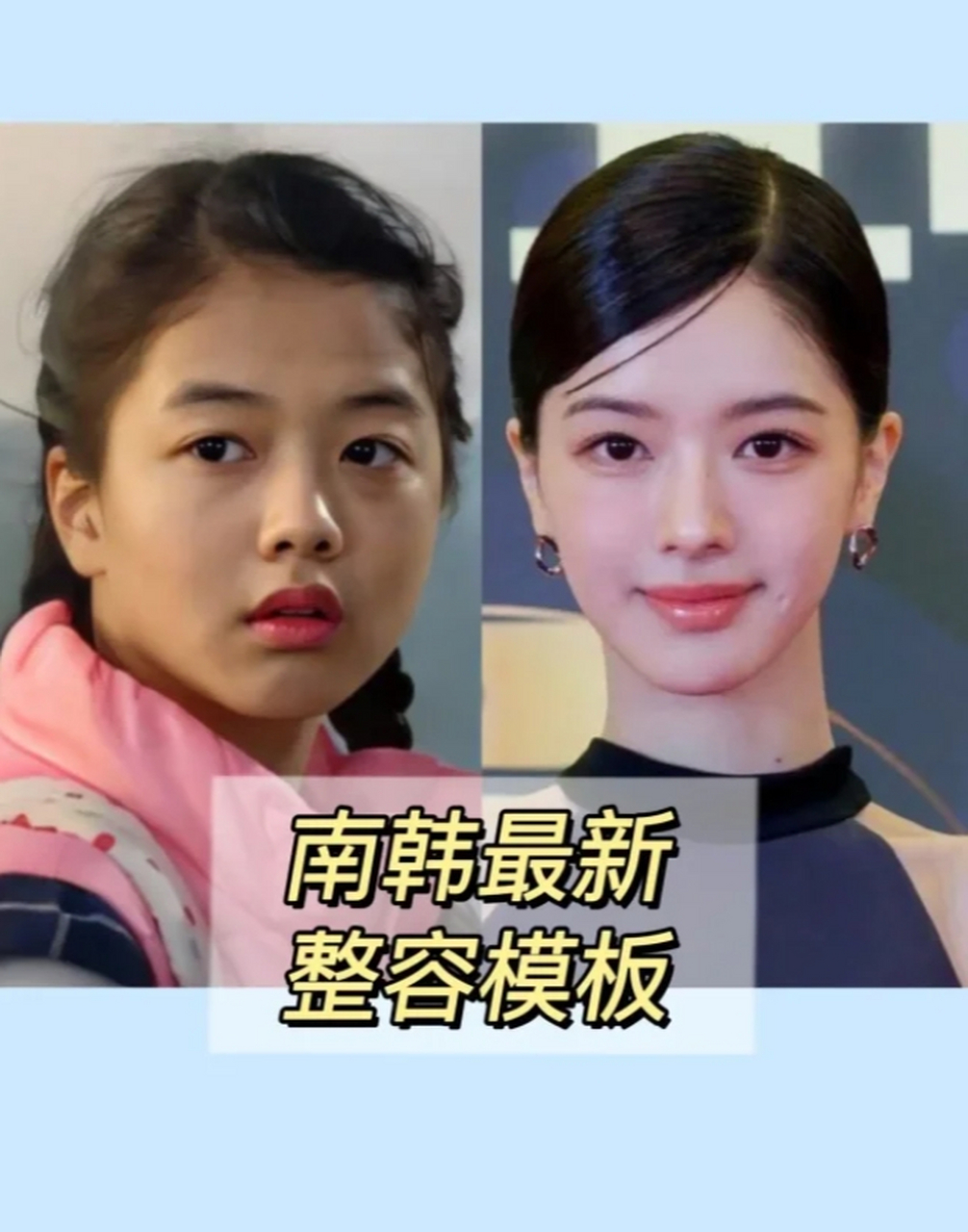 南韩最新整容模板 想知道韩国最新整容模板卢正义美在哪里?