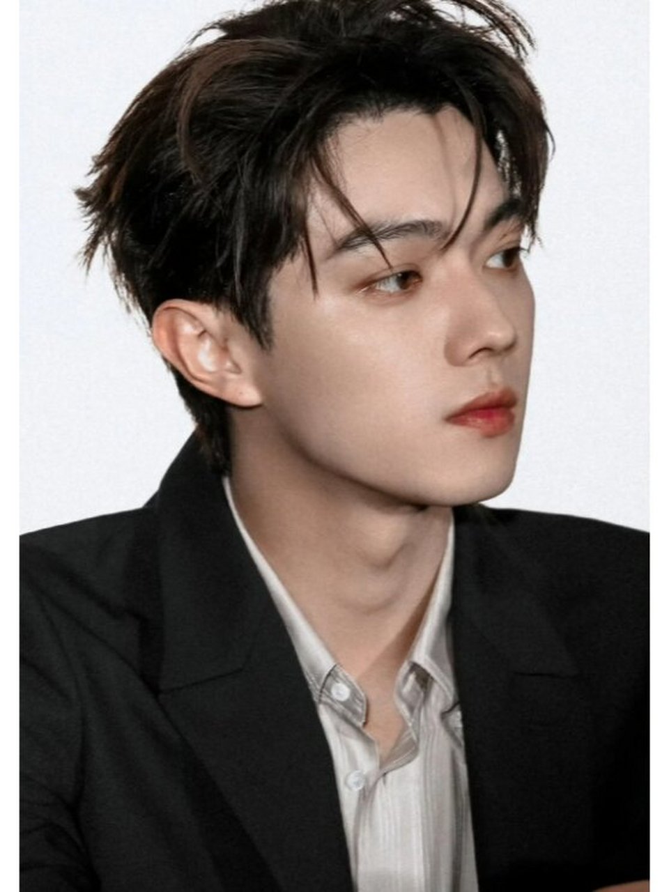 坦率承认植发,发际线弧度自然且适中.