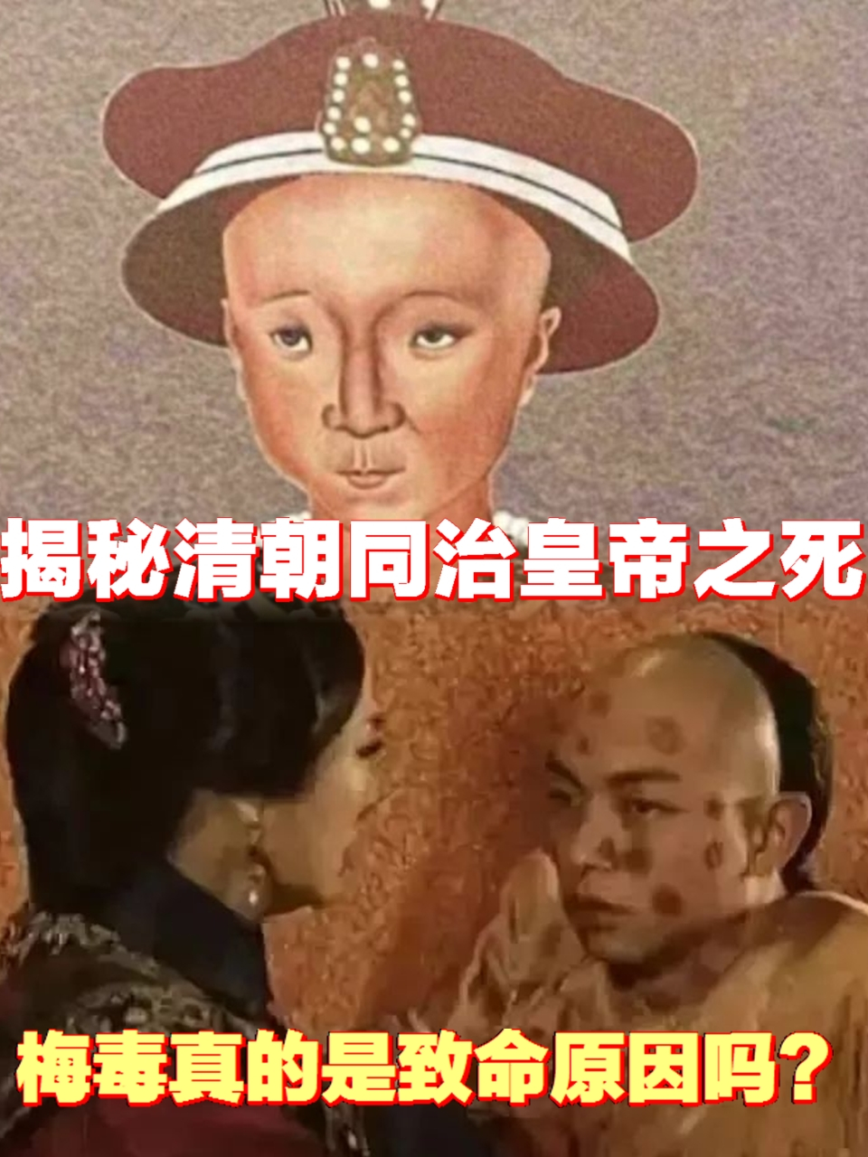 同治帝死因图片