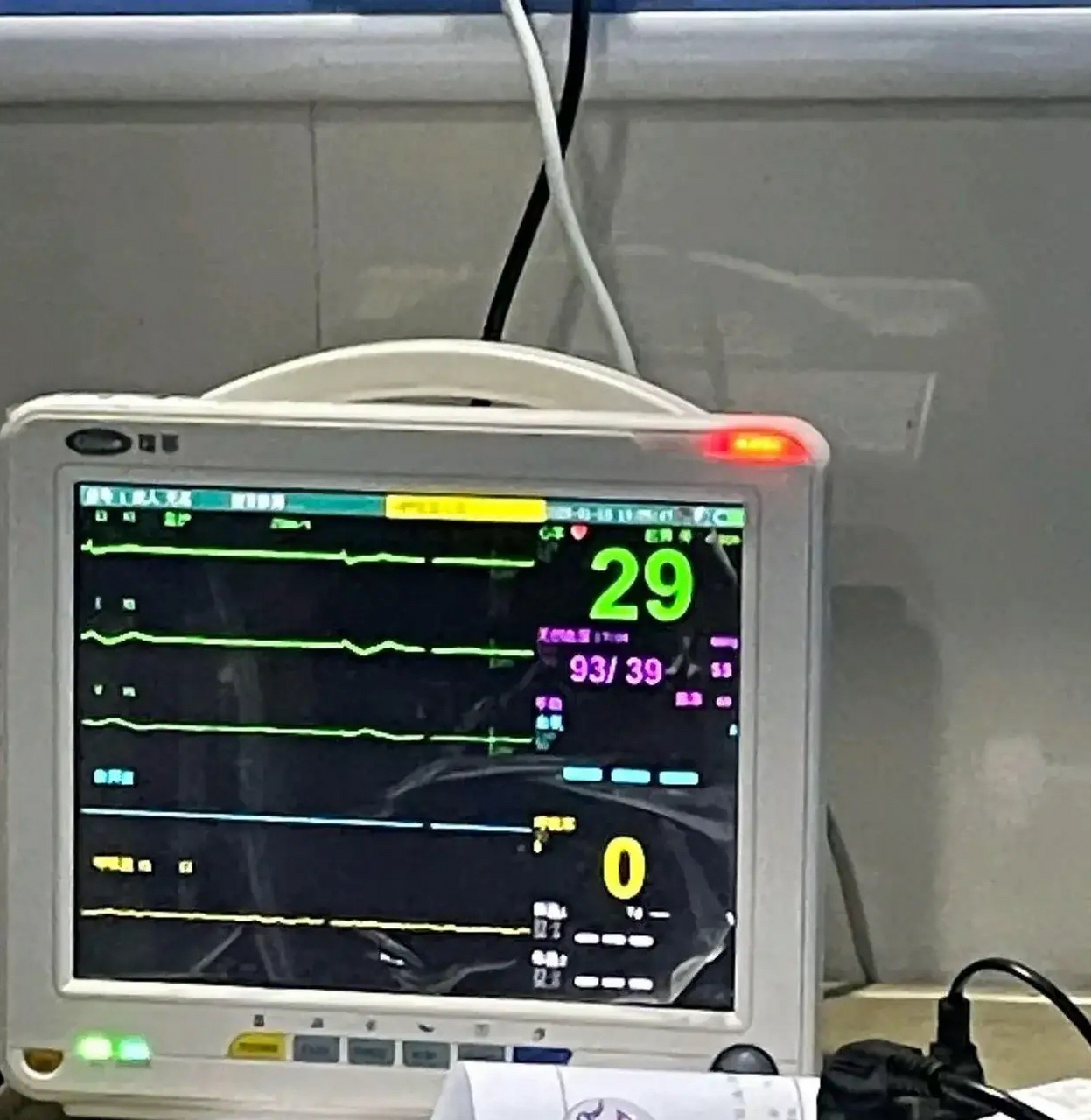 心跳本来己经是直线,偶尔又跳一跳