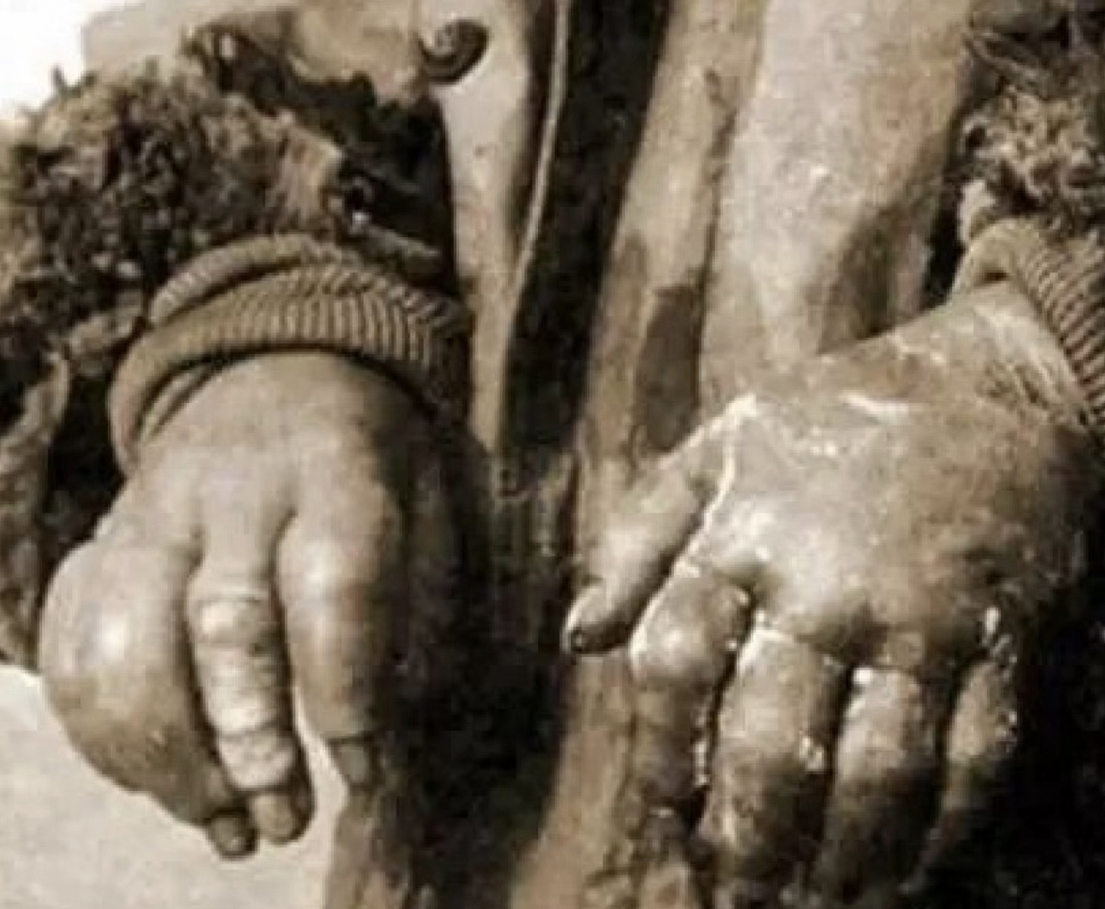 被731部队冻伤的手…15岁的孩子,被放入冰柜,哭声停止,不再挣扎后