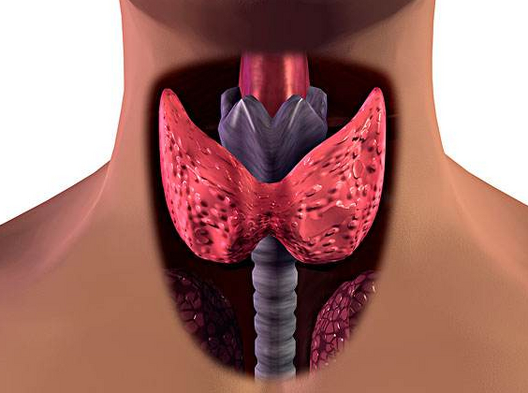 切除甲状腺对身体影响多大?
