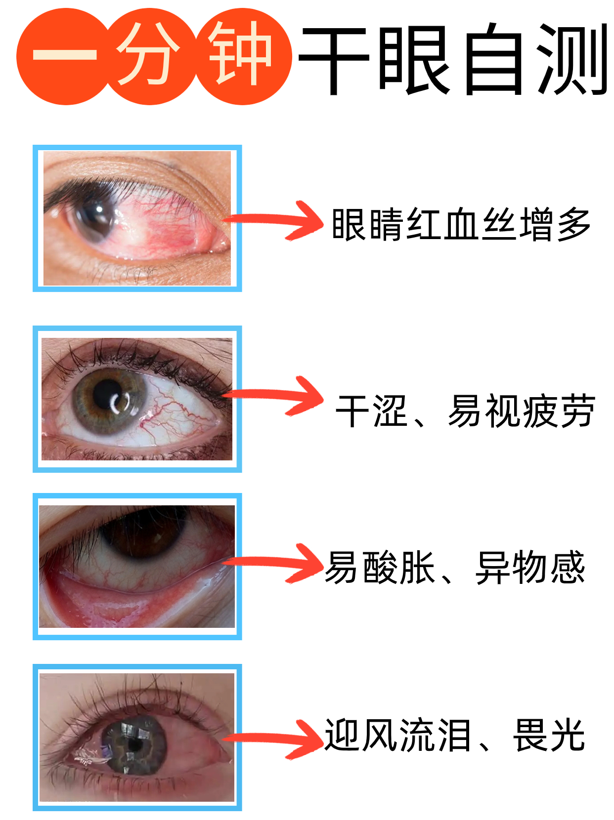 10秒自测干眼,看看你有没有中招