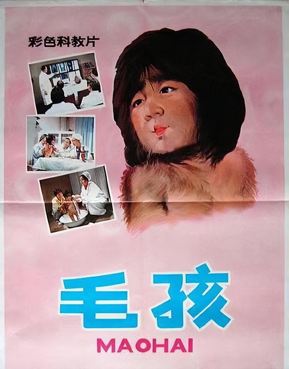 "毛孩"于震寰:46年前因一身黑毛轰动全国,如今他怎么样了?