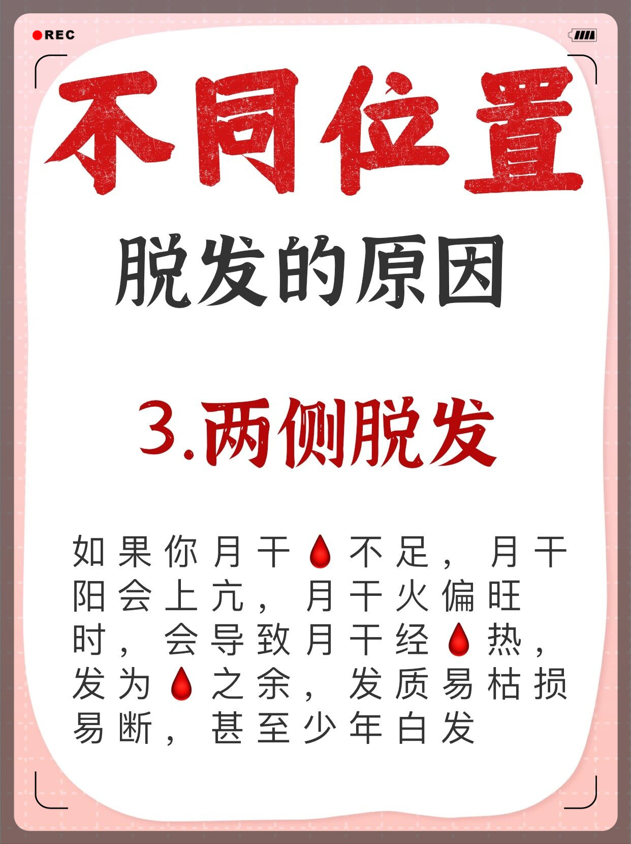 为什么头发油了就容易掉头发