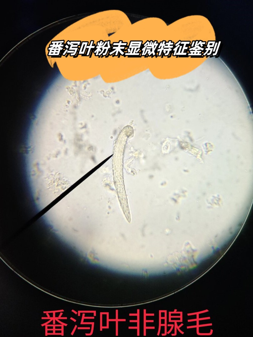 番泻叶粉末显微特征鉴别